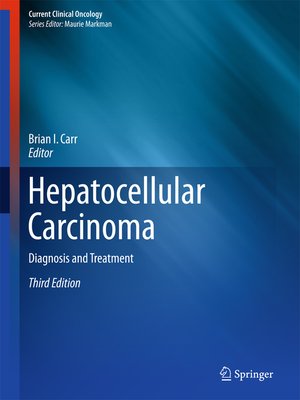 cover image of Hepatocellular Carcinoma